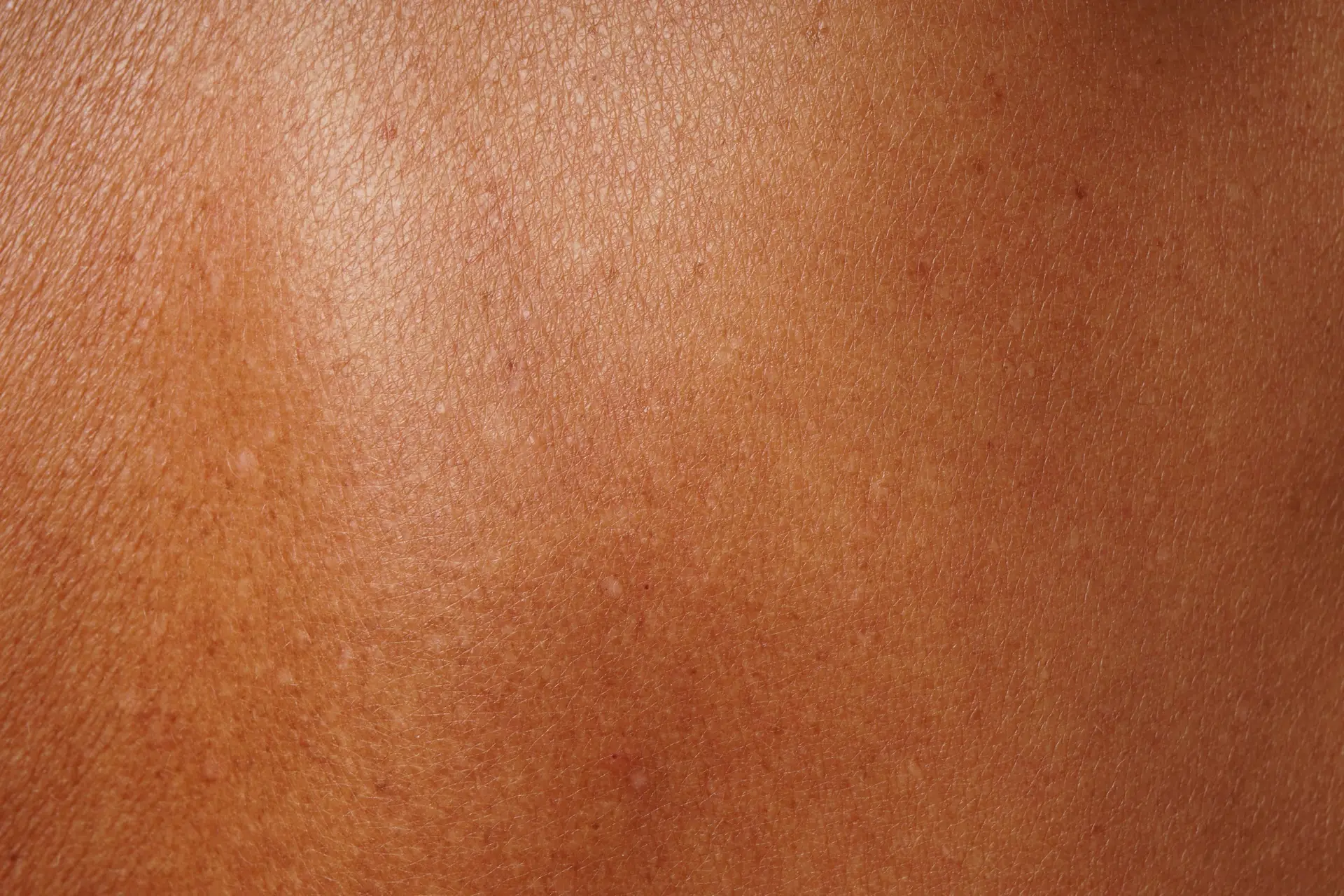 close-up human skin damaged by age and sun tanning